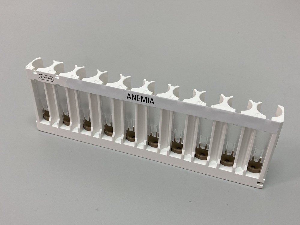 HbA0異常低値 – ARKRAY INFINITY FAQ